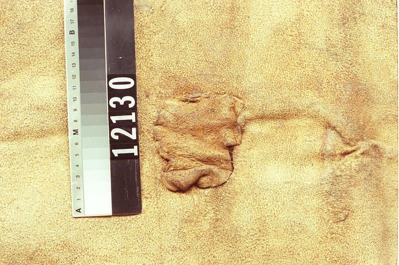 Image representing Skin.
