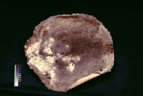 Image representing Skin.