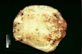 Image representing Skin.