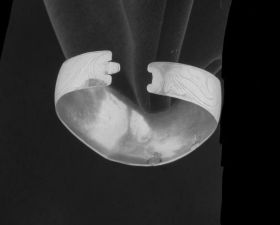 Image representing Bracelet.